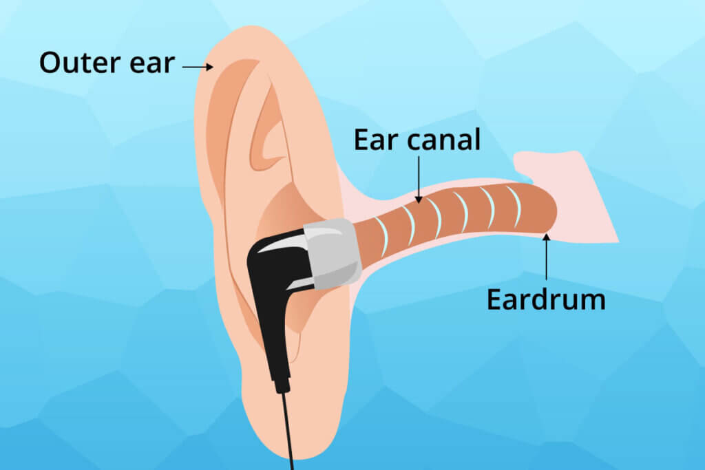earbud placement diagram